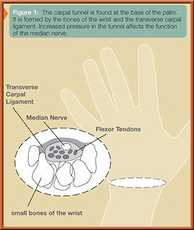 fig1