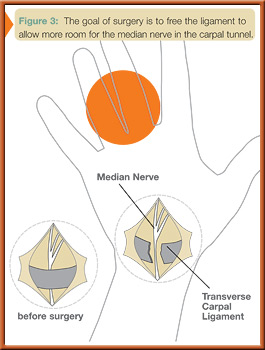 fig3