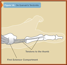 fig1a