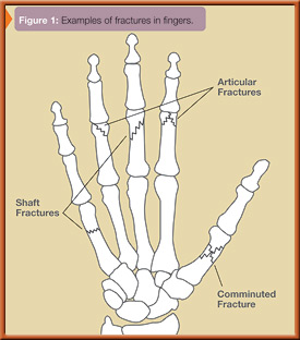 fig1