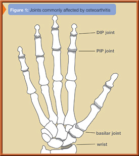 fig1