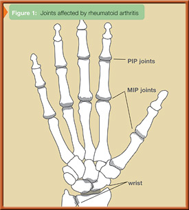 fig1