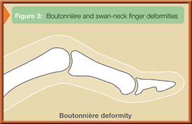 fig3a