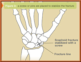 fig3