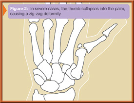 fig2